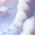 What A Dental Assistant Can Do To Assist Your Dentist During Invisalign Treatment In Georgetown