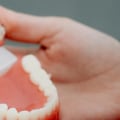 Get A Straighter Smile Without The Hassle: The Convenience Of Invisalign From A Woden Dentist