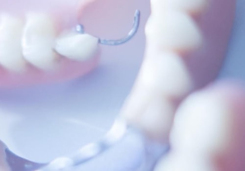 What A Dental Assistant Can Do To Assist Your Dentist During Invisalign Treatment In Georgetown