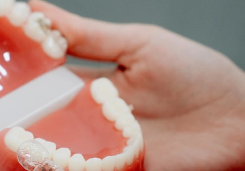 Get A Straighter Smile Without The Hassle: The Convenience Of Invisalign From A Woden Dentist